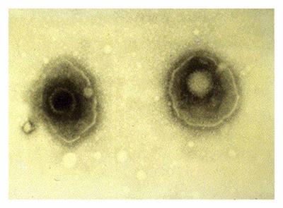 Molecular Mechanisms for Herpes Simplex Virus Type 1 Pathogenesis in Alzheimer’s Disease